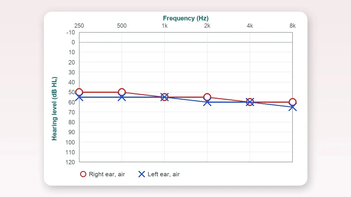 OTC Hearing Aids vs AirPods vs Prescription Hearing Aids in 2026: What Actually Helps Mild Hearing Loss (and When You Still Need an Audiologist)