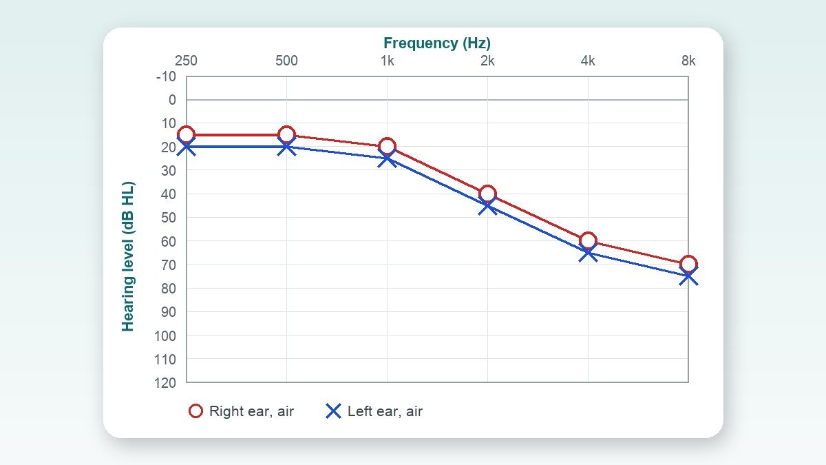 What Your Hearing Reveals About Your Heart and Kidneys (and When It's an Emergency)
